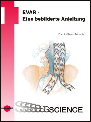 cover image of EVAR--Eine bebilderte Anleitung